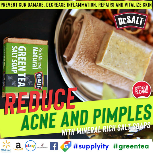 Green Tea Acne Soap: Clear Skin Naturally for a Radiant Complexion